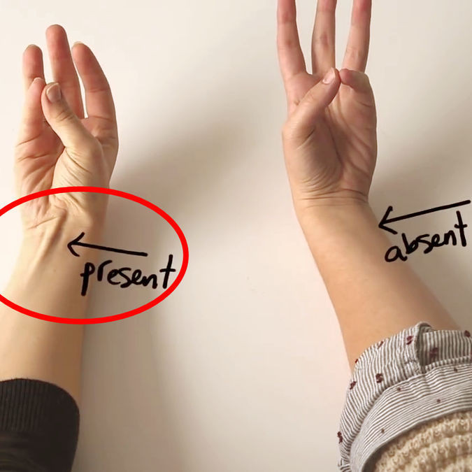 Какие мышцы на руках отсутствуют у каждого шестого человека?