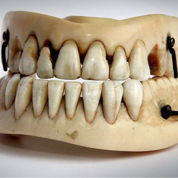 Где раньше брали материал для искусственных зубов?