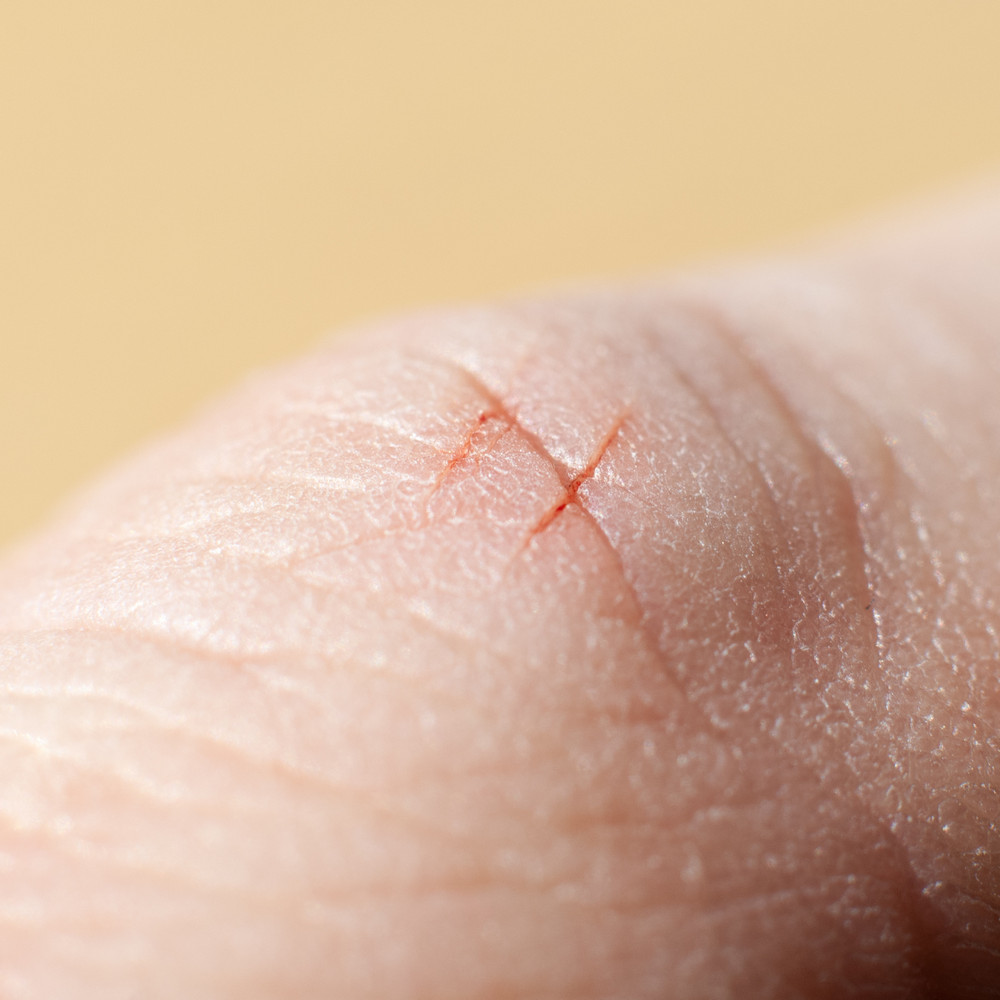 Почему порез бумагой может вызвать гораздо более острую боль, чем порез ножом?