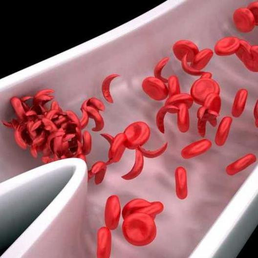 Почему гемоглобин S одновременно и вреден, и полезен для выживания человека?